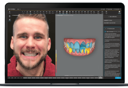 proiectare zambet software pentru simularea fațetelor dentare care se face înaintea tratamentului ortodontic