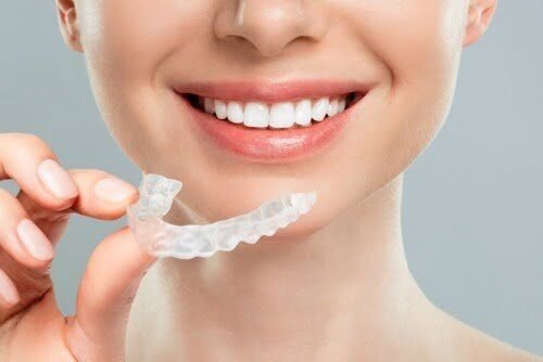 Purtarea gutierelor invisalign intre 20 si 22 de ore pe zi
