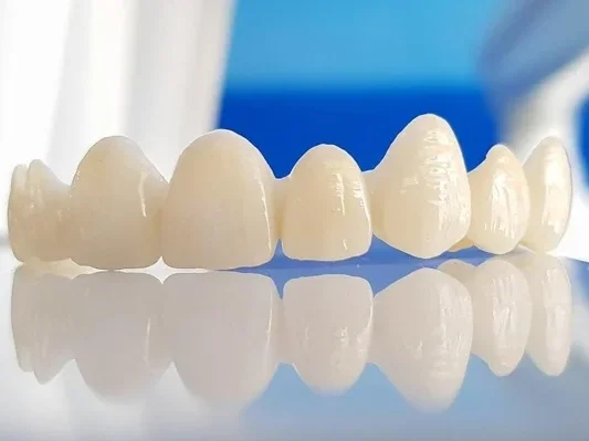 Lucrare dentara de zirconiu Lucrari protetice