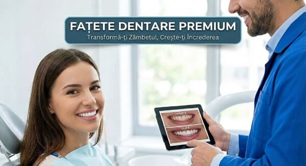 fatete dentare fatete dentare